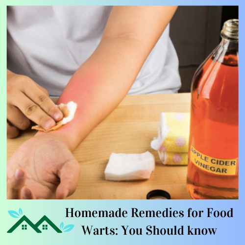 Homemade Remedies for Food Warts